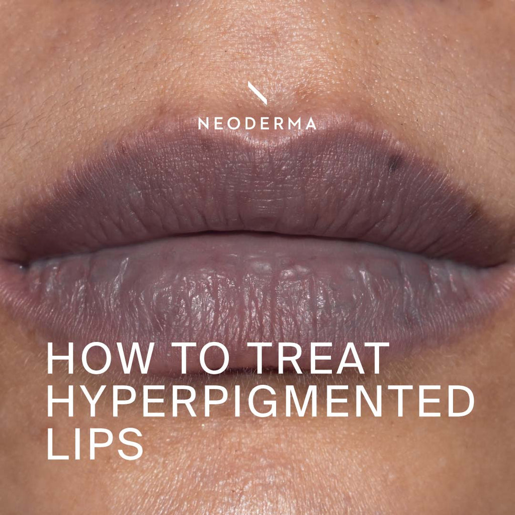 How to Treat Hyperpigmented Lips