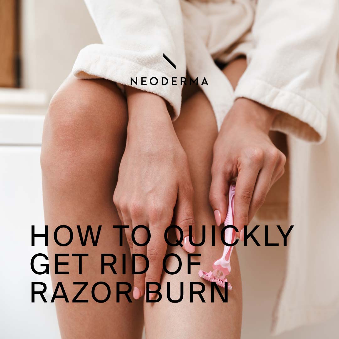 How to Quickly Get Rid of Razor Burn