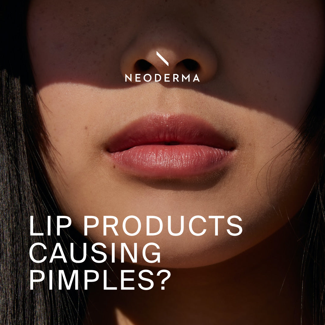 Lip Products Causing Pimples?