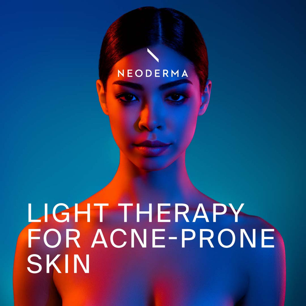 Light Therapy for Acne-Prone Skin