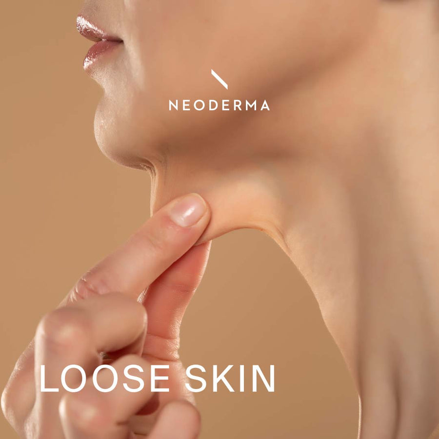 Loose Skin