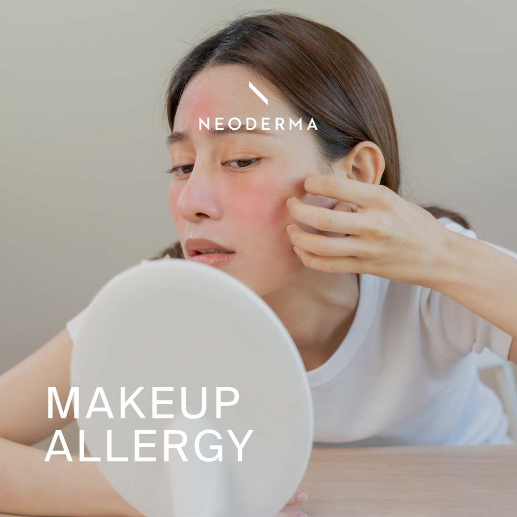 Makeup Allergy