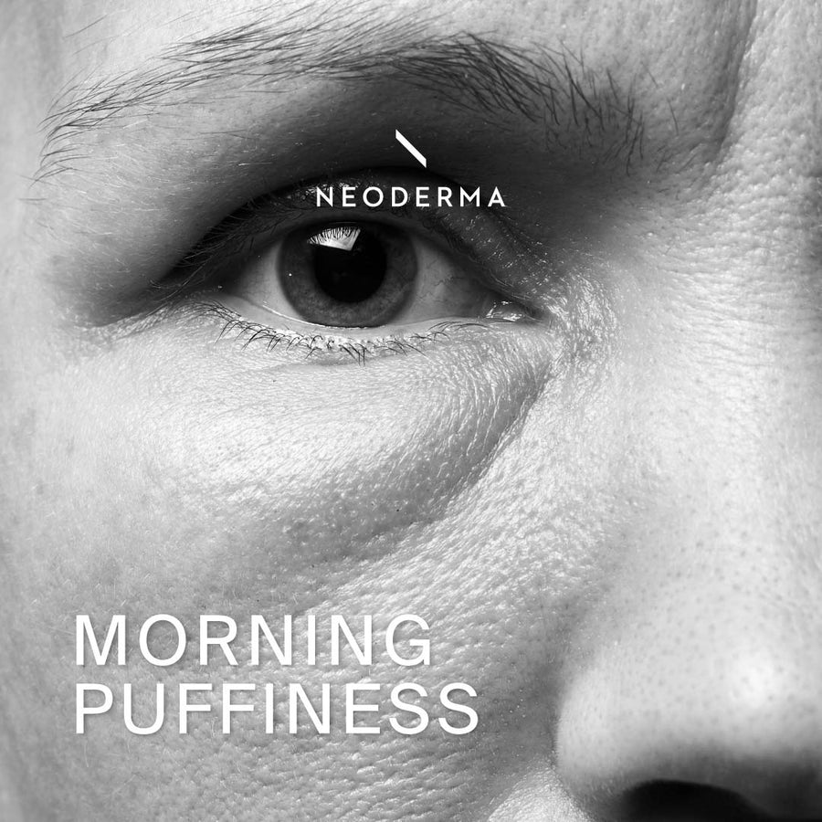 Morning Puffiness