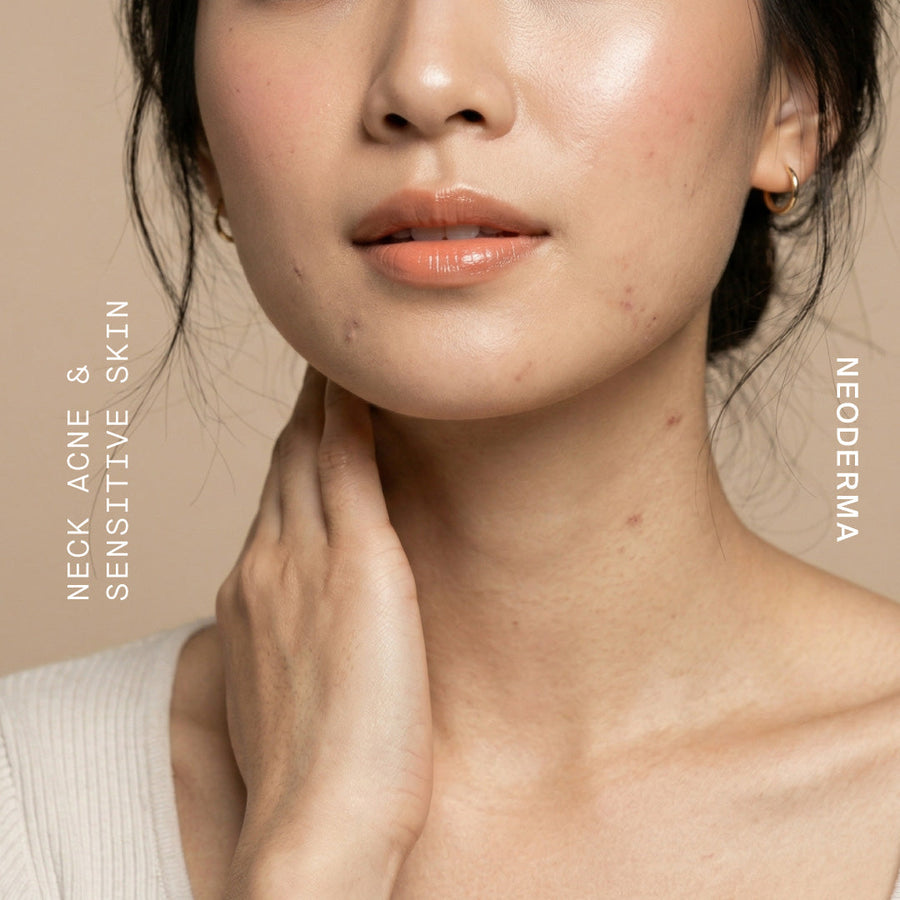 Neck Pimples & Acne-Prone, Sensitive Skin