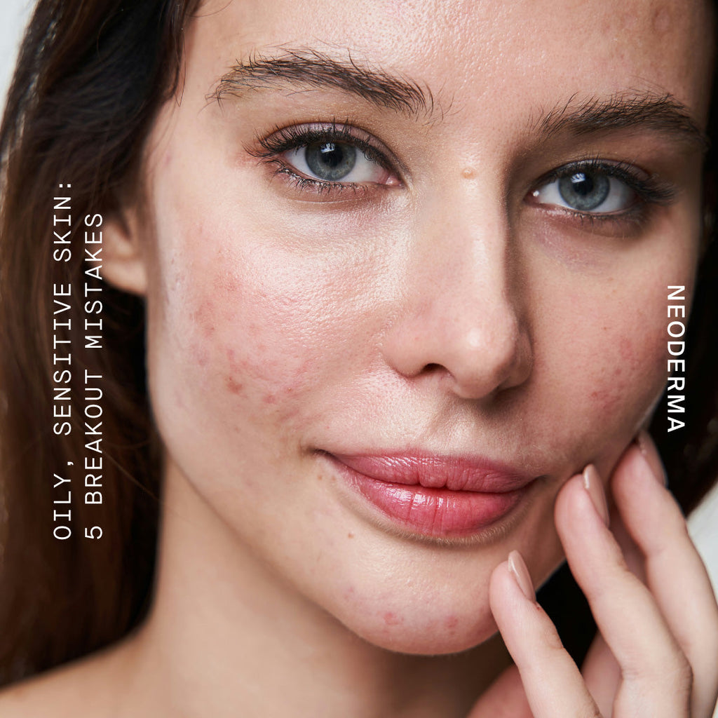 Oily, Sensitive Skin: 5 Things You Should Never Do When You're Breaking Out