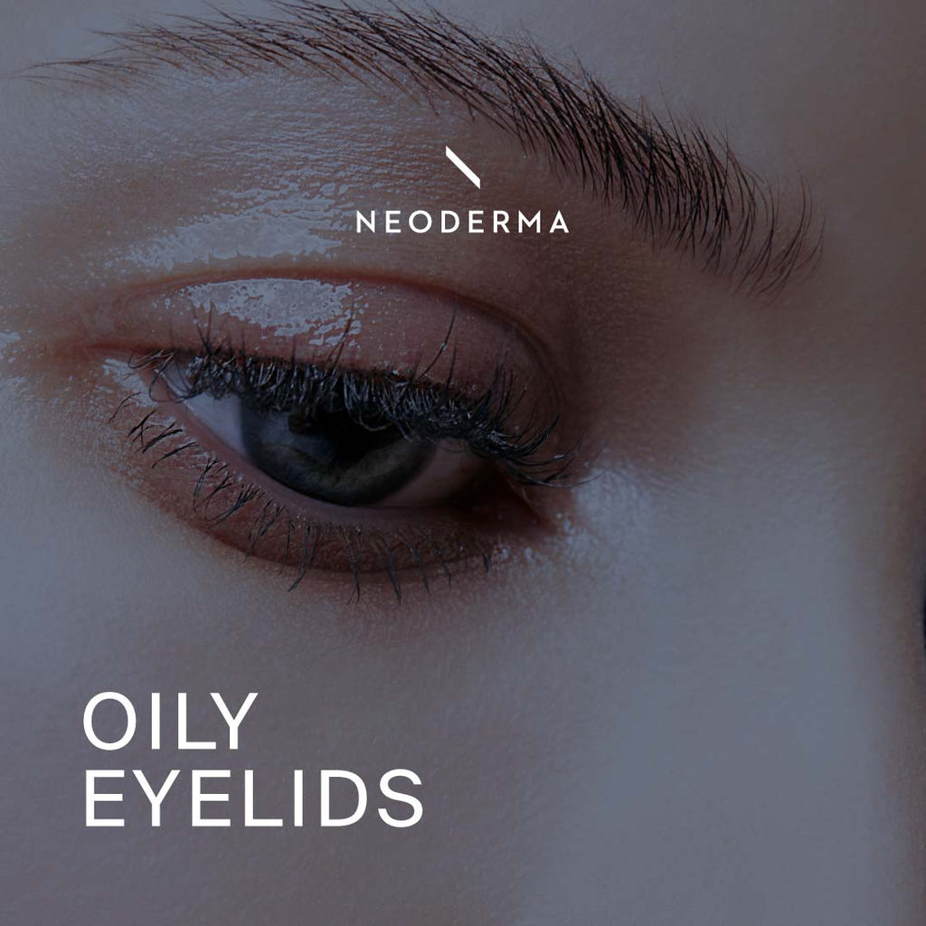 Oily Eyelids