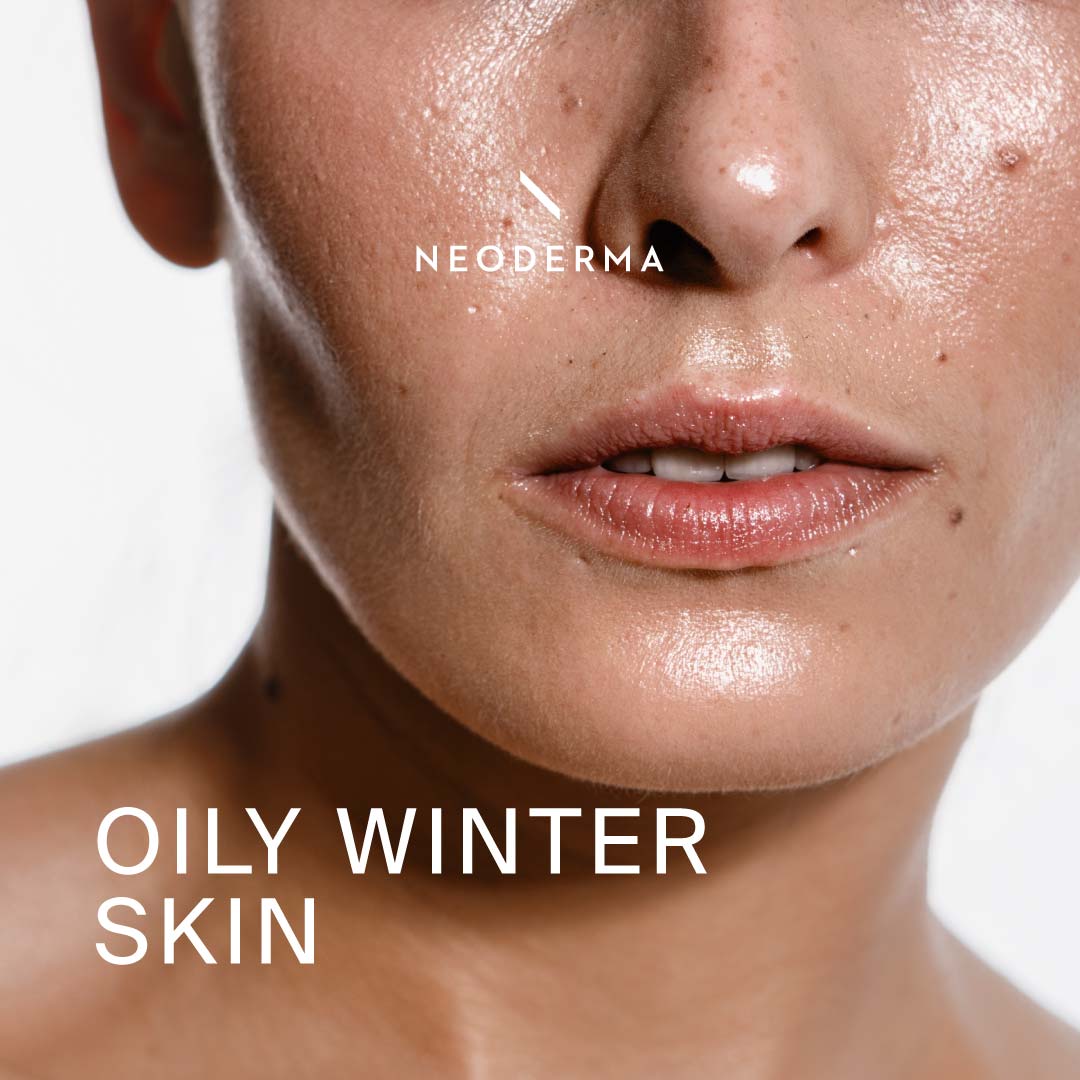 Oily Winter Skin