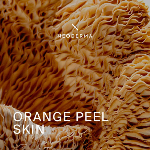 Orange Peel Skin