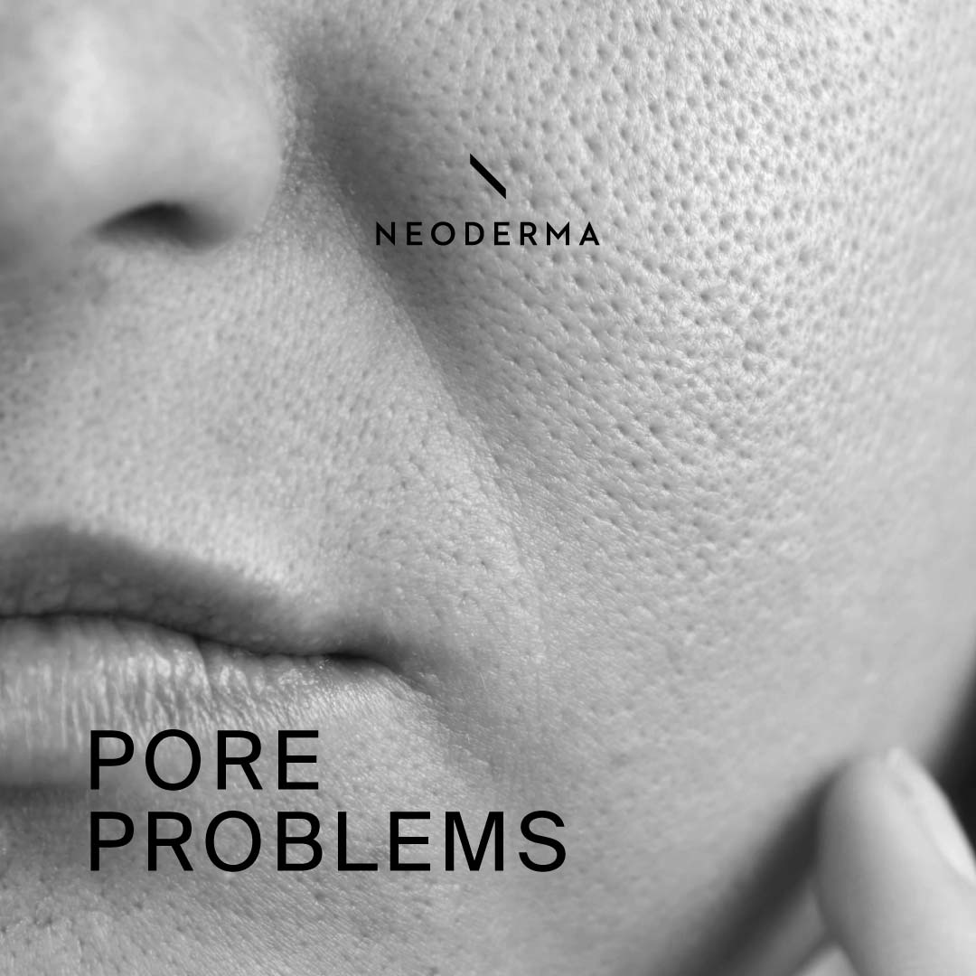 Open Skin Pore Problems | NEODERMA