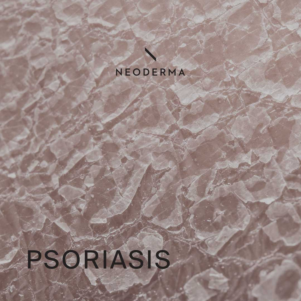 Psoriasis