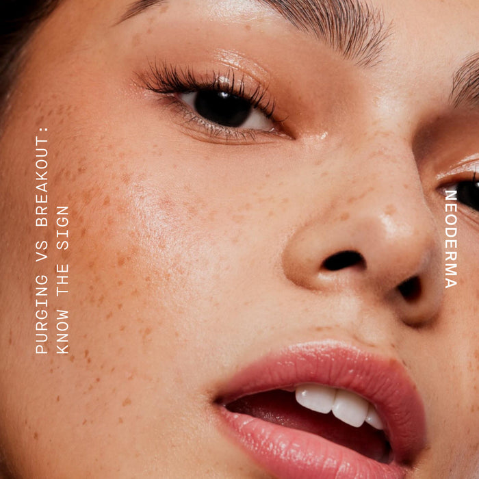 Acne-Prone, Sensitive Skin: How to Tell If Your Anti-Aging Product Is Purging or Breaking You Out