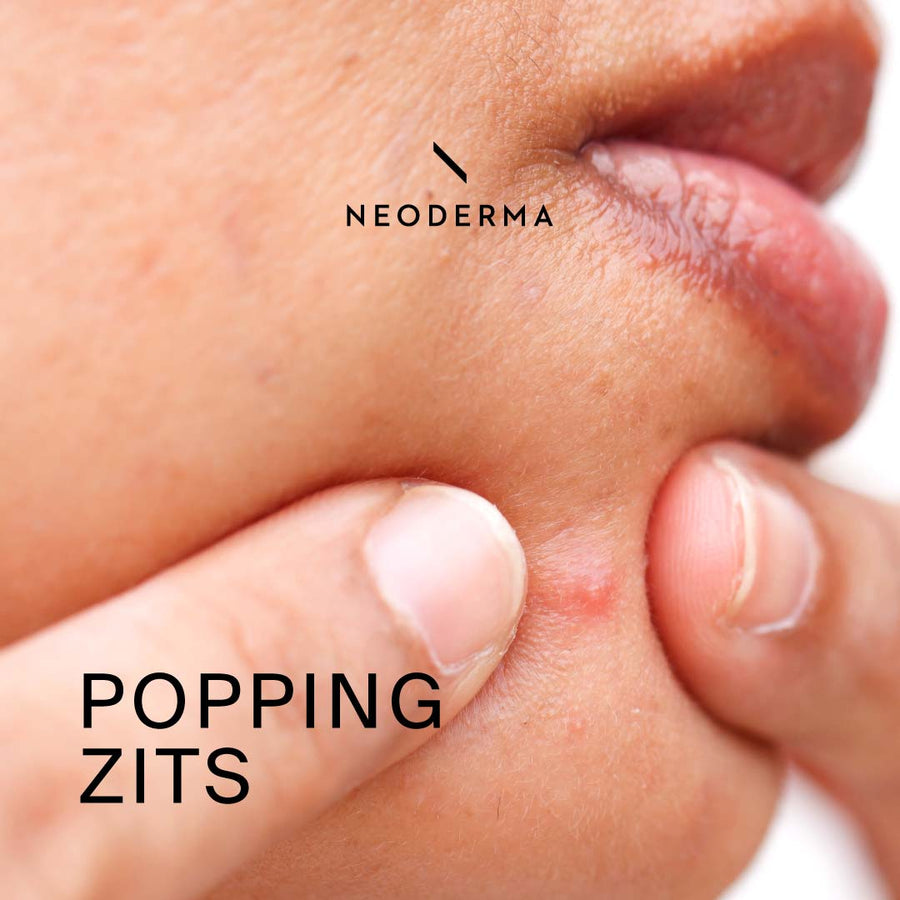 Popping Zits