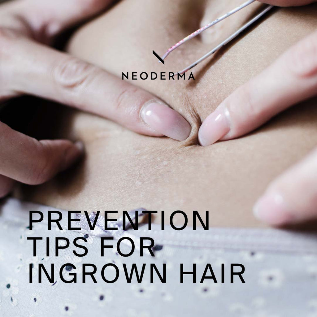 Prevention Tips for Ingrown Hair