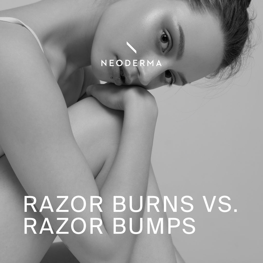 Razor Burns Vs. Razor Bumps