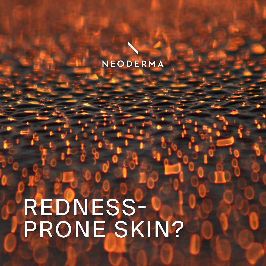 Redness-Prone Skin?