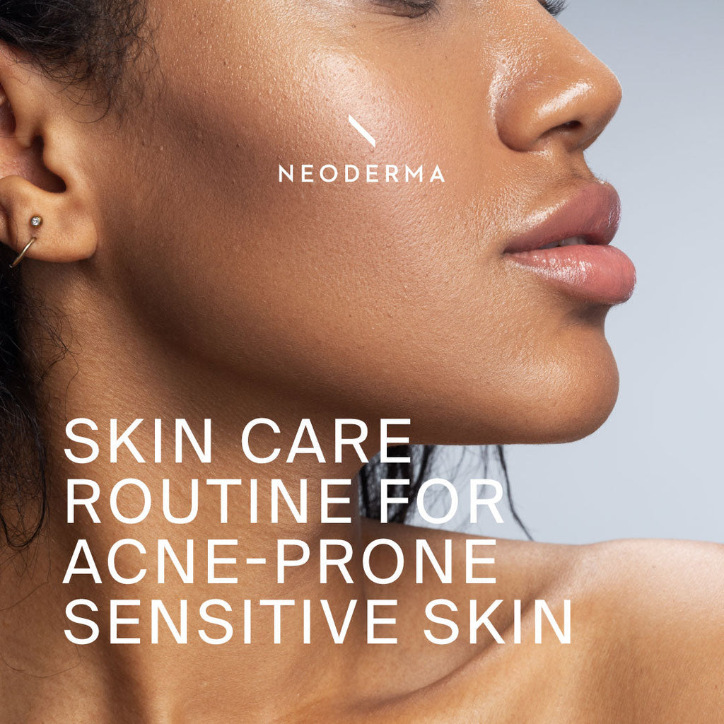 Skin Care Routine for Acne-Prone Sensitive Skin