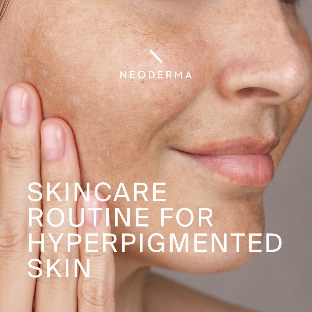 Skincare Routine for Hyperpigmented Skin