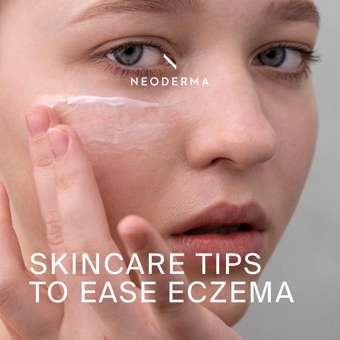 Skincare Tips to Ease Eczema