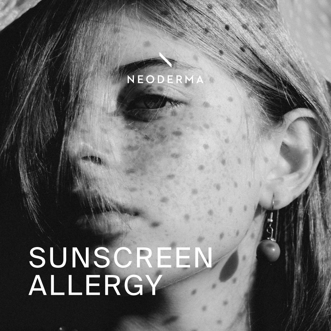 Sunscreen Allergy Symptoms and Sunscreen Reaction | NEODERMA