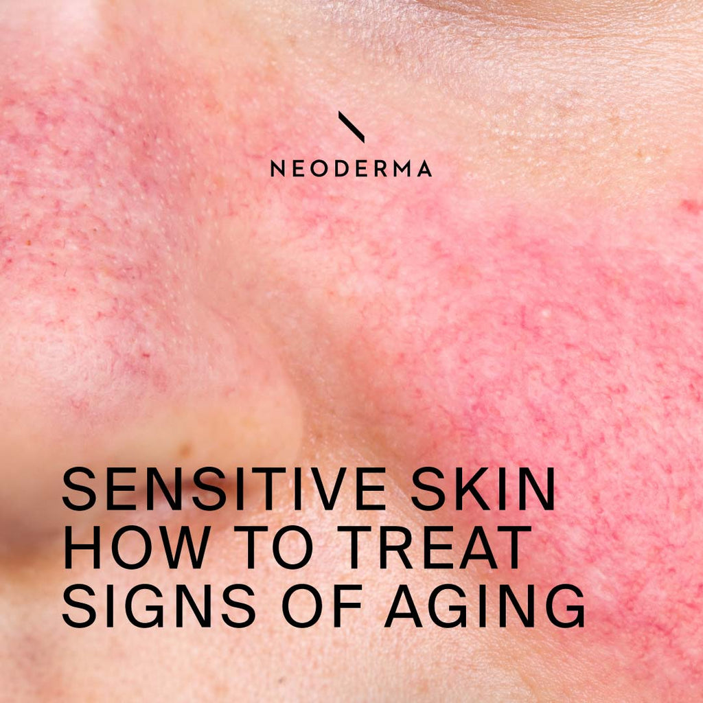 Sensitive Skin, How to Treat Signs of Aging