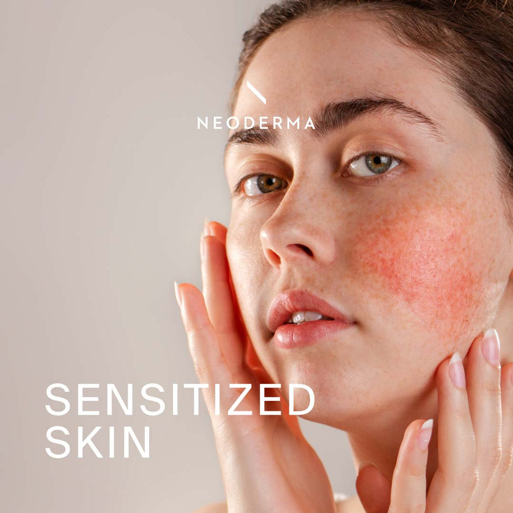 Sensitized Skin