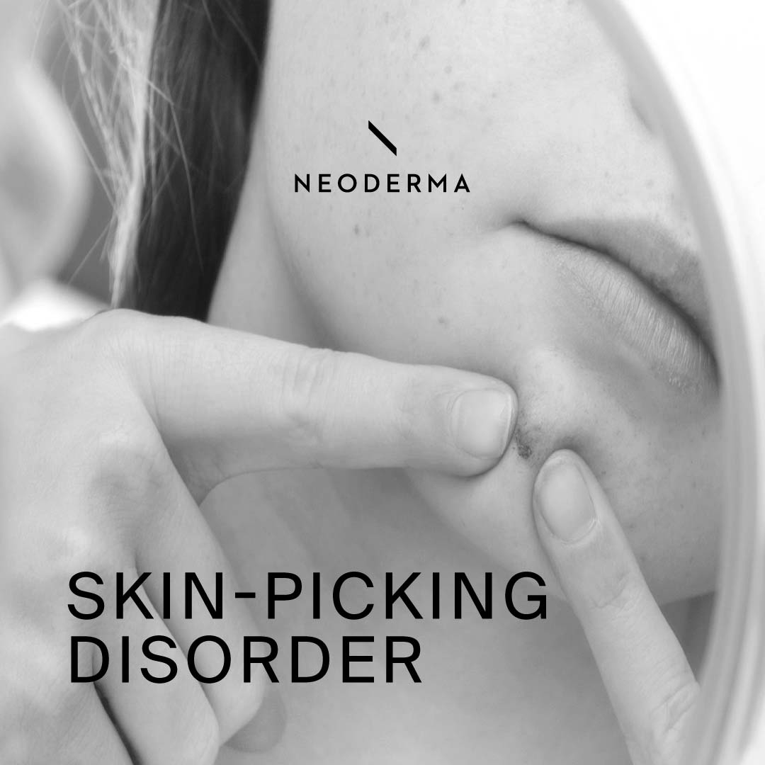 Skin-Picking-Disorder: Ursachen Und Hilfe – NUUWI