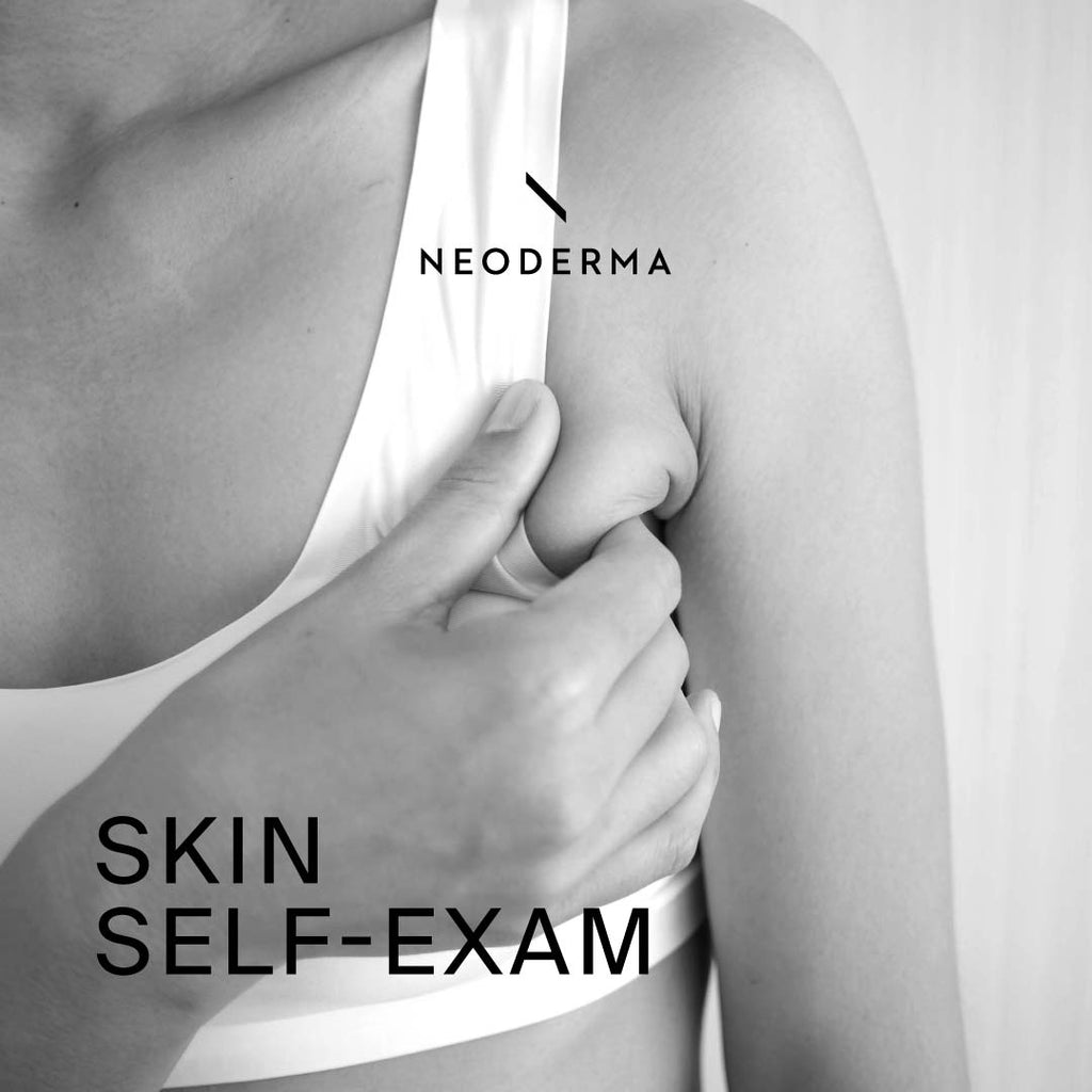 Skin Self-Exam