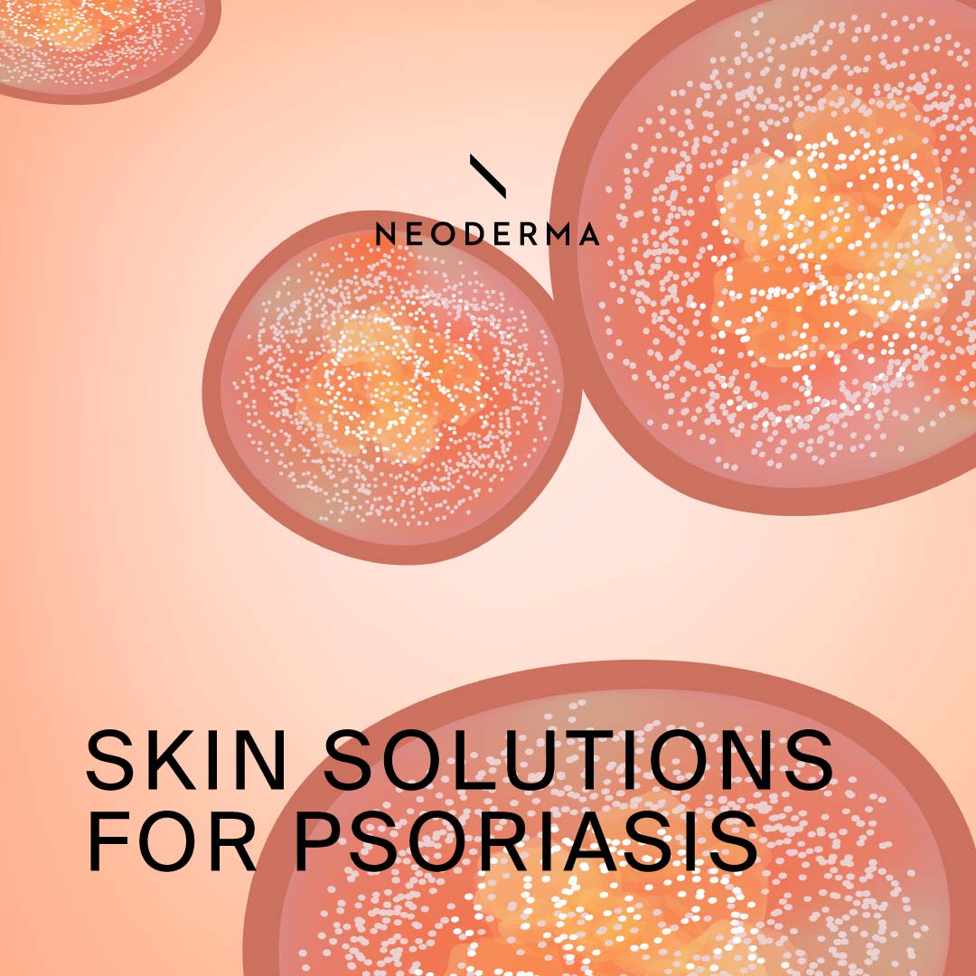 Neoderma Solution Skin Solutions for Psoriasis – NEODERMA