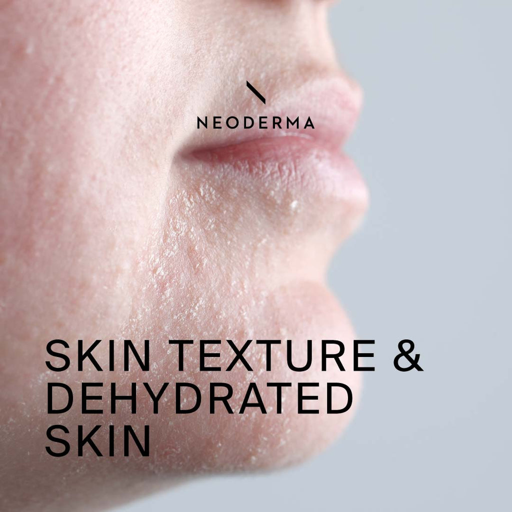 Skin Texture & Dehydrated Skin