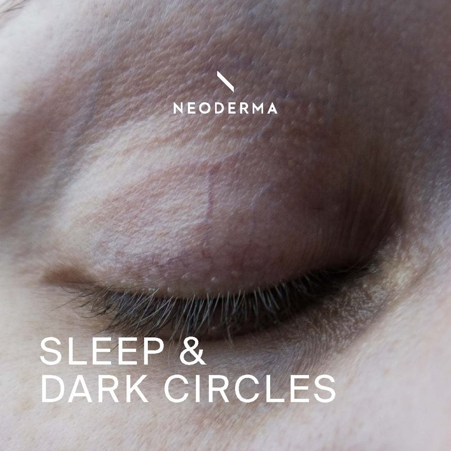 Sleep & Dark Circles