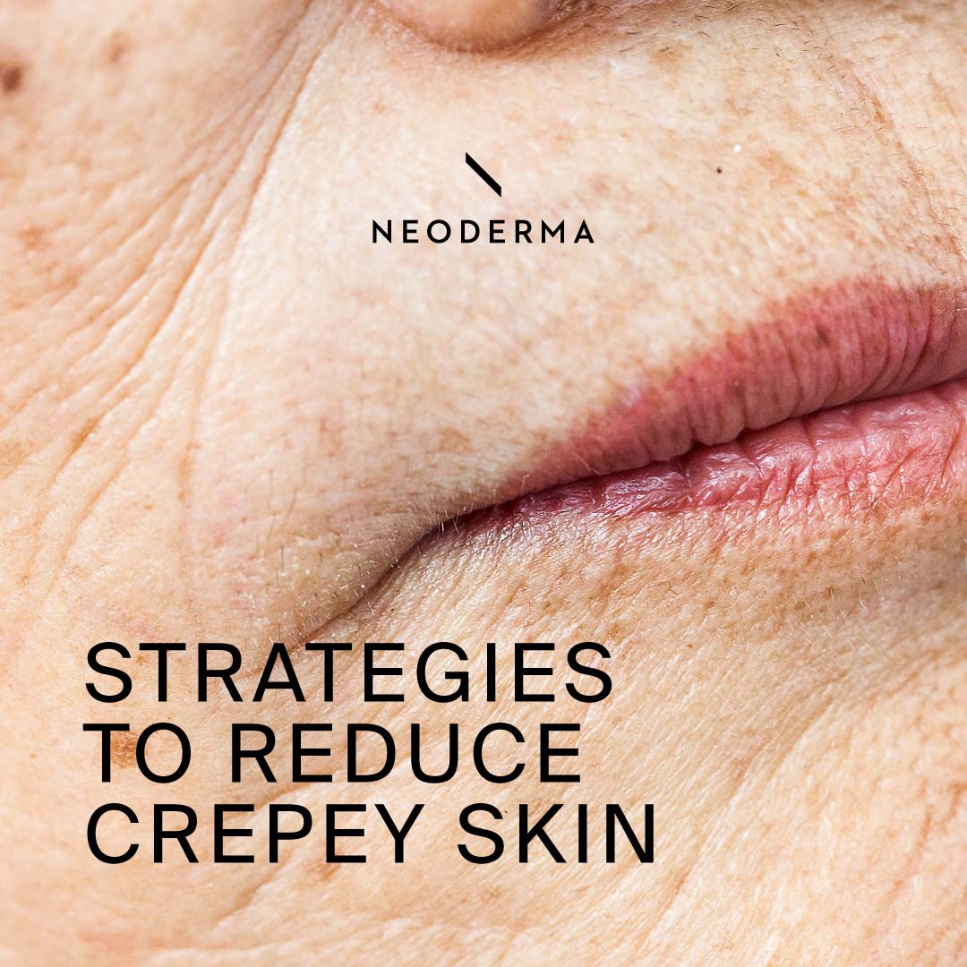 Strategies to Reduce Crepey Skin