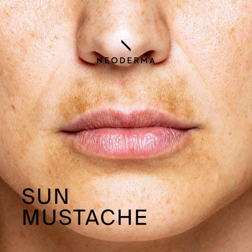 Sun Mustache