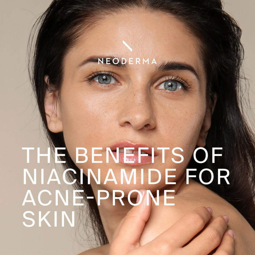 The Benefits Of Niacinamide for Acne-Prone Skin