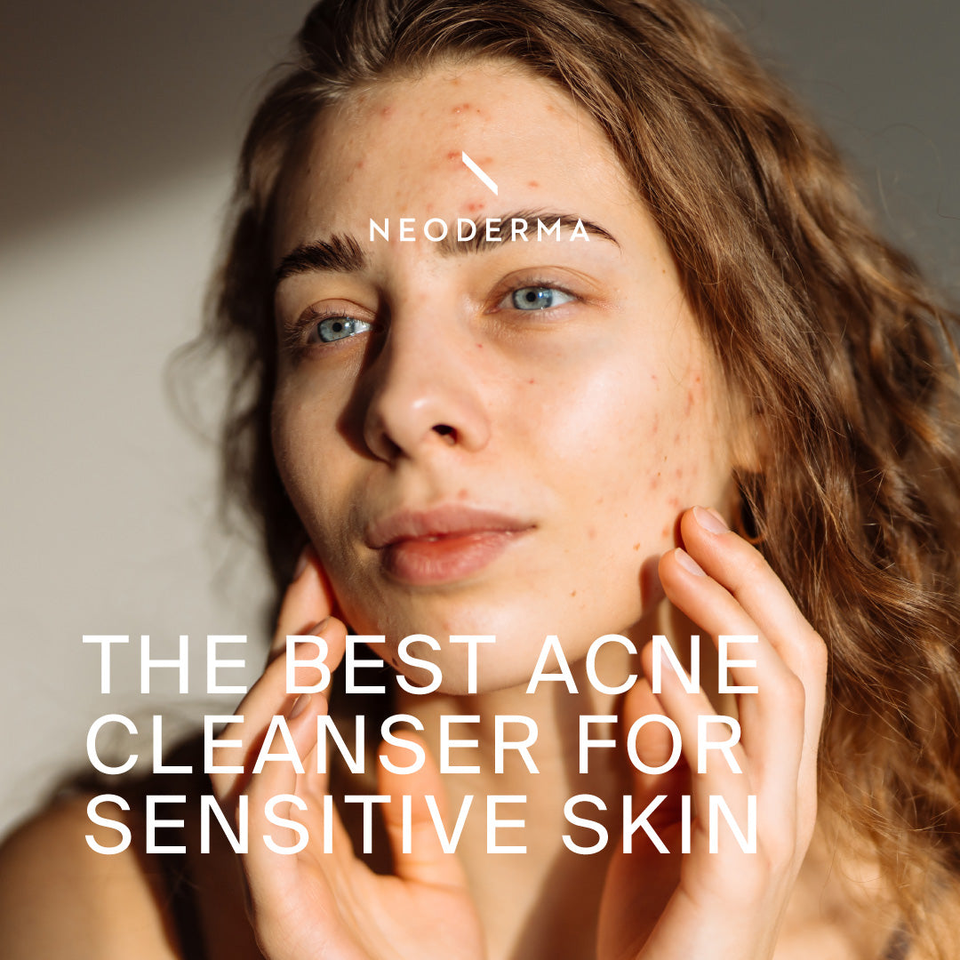 The Best Acne Cleanser For Sensitive Skin
