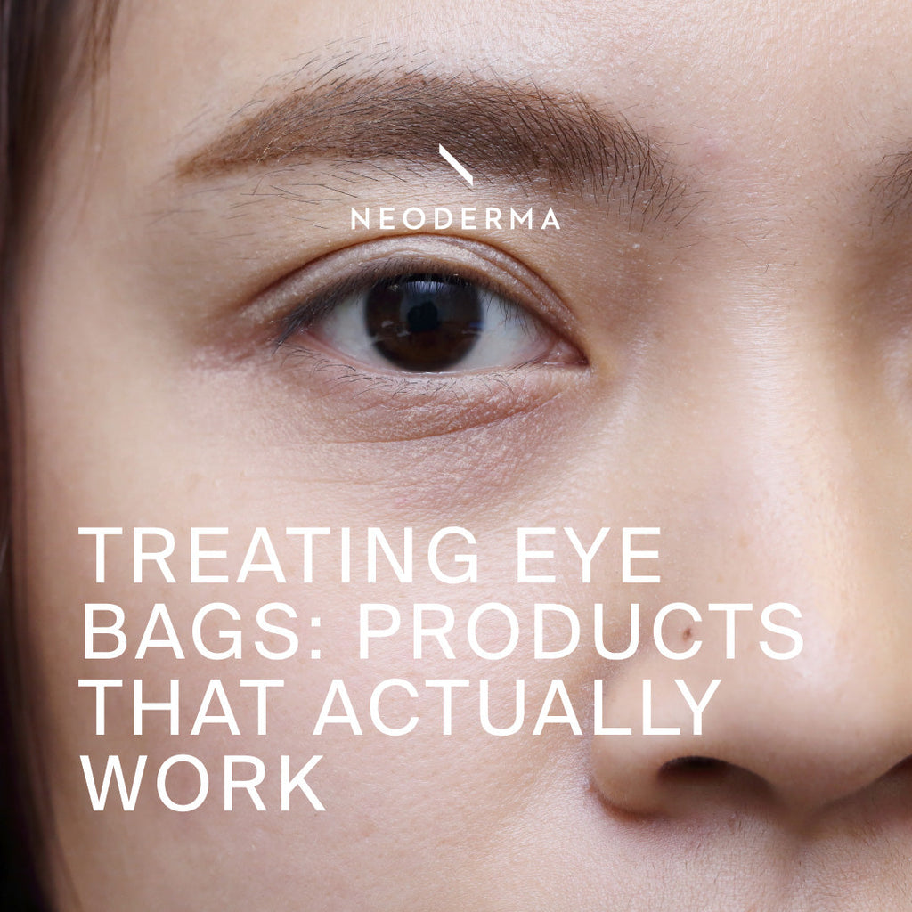How To Treat Eye Bags & The Skin Care Products For Eye Bags That Actually Help