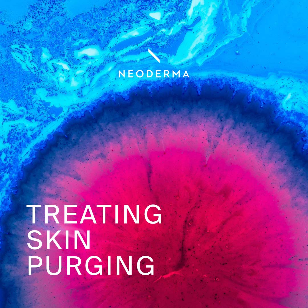 Treating Skin Purging