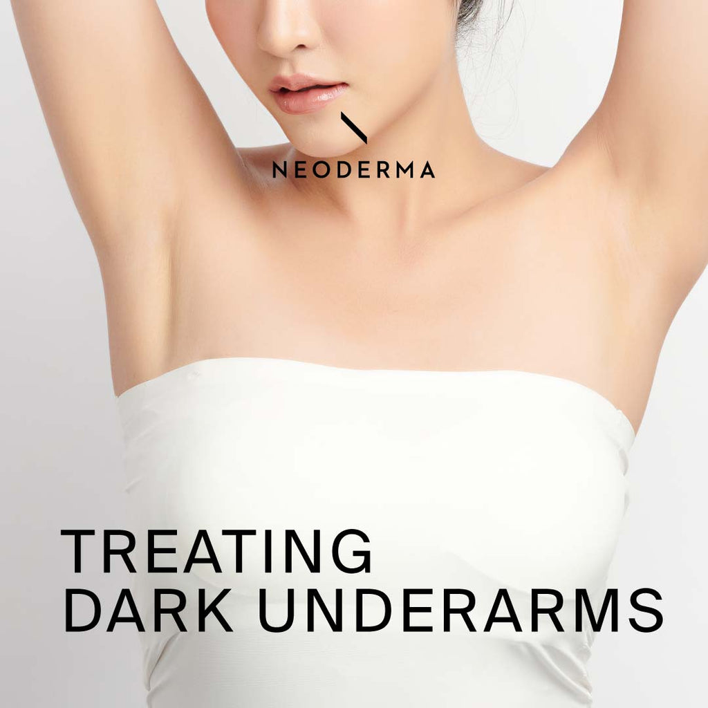 Treating Dark Underarms