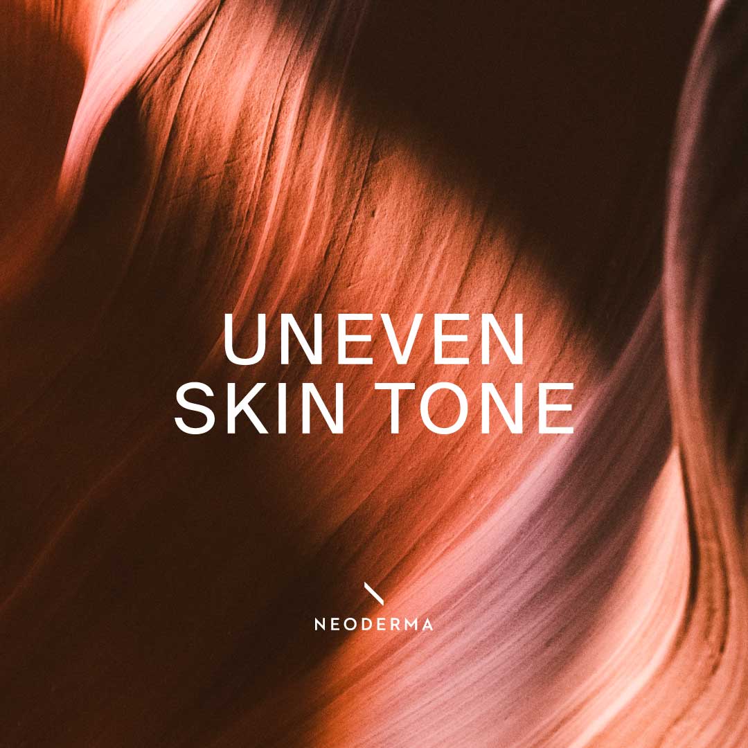 Uneven Skin Tone