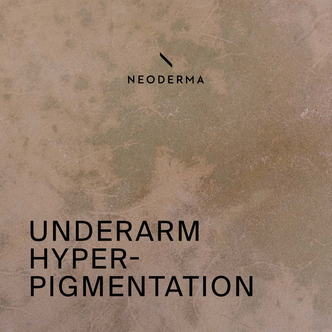 Underarm Hyperpigmentation