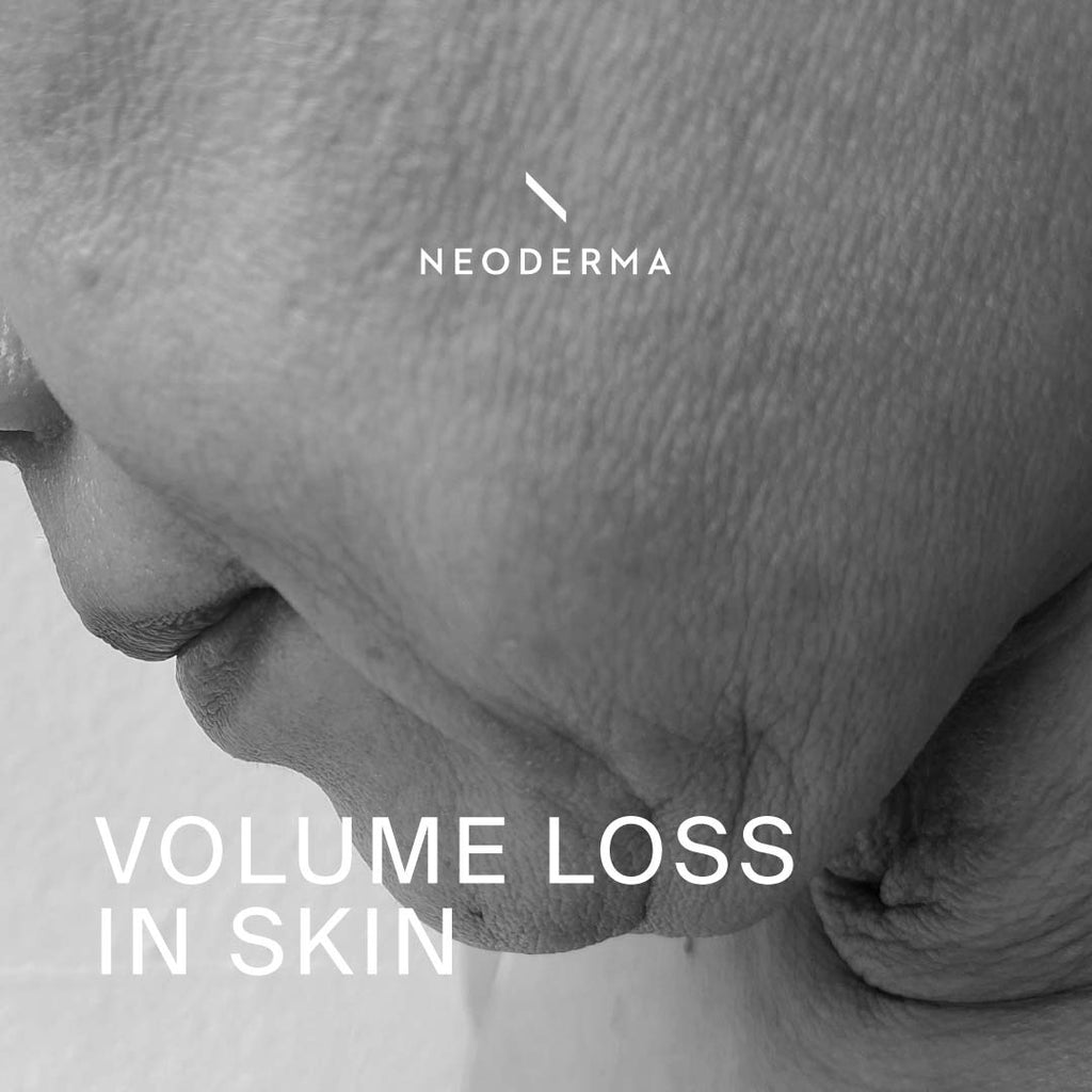 Volume Loss In Skin