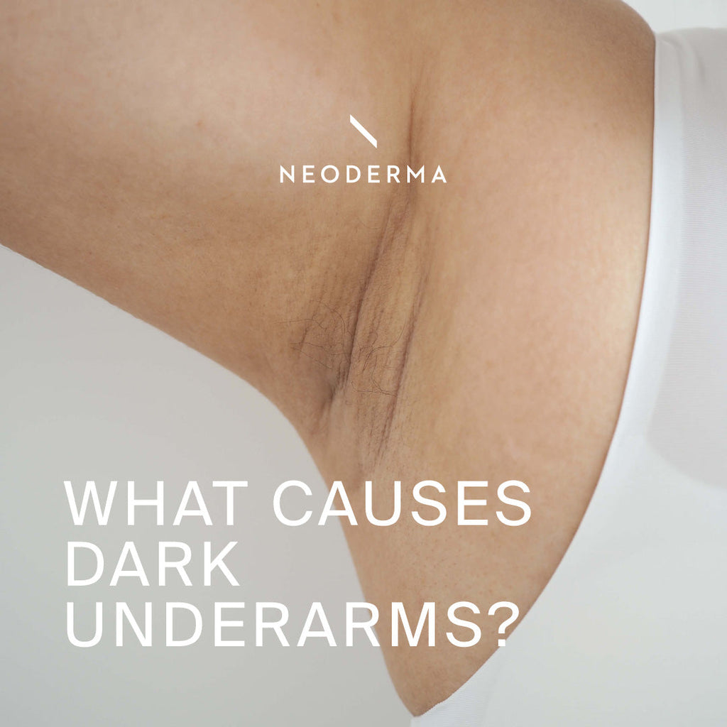 What Causes Dark Underarms?