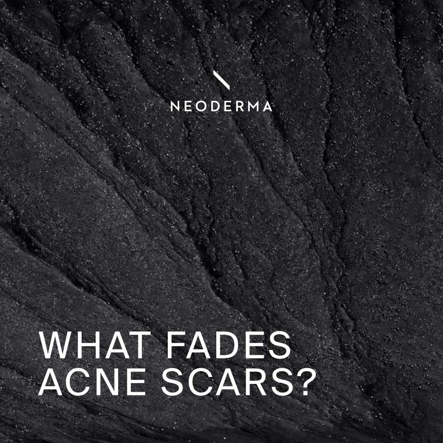 What Fades Acne Scars?