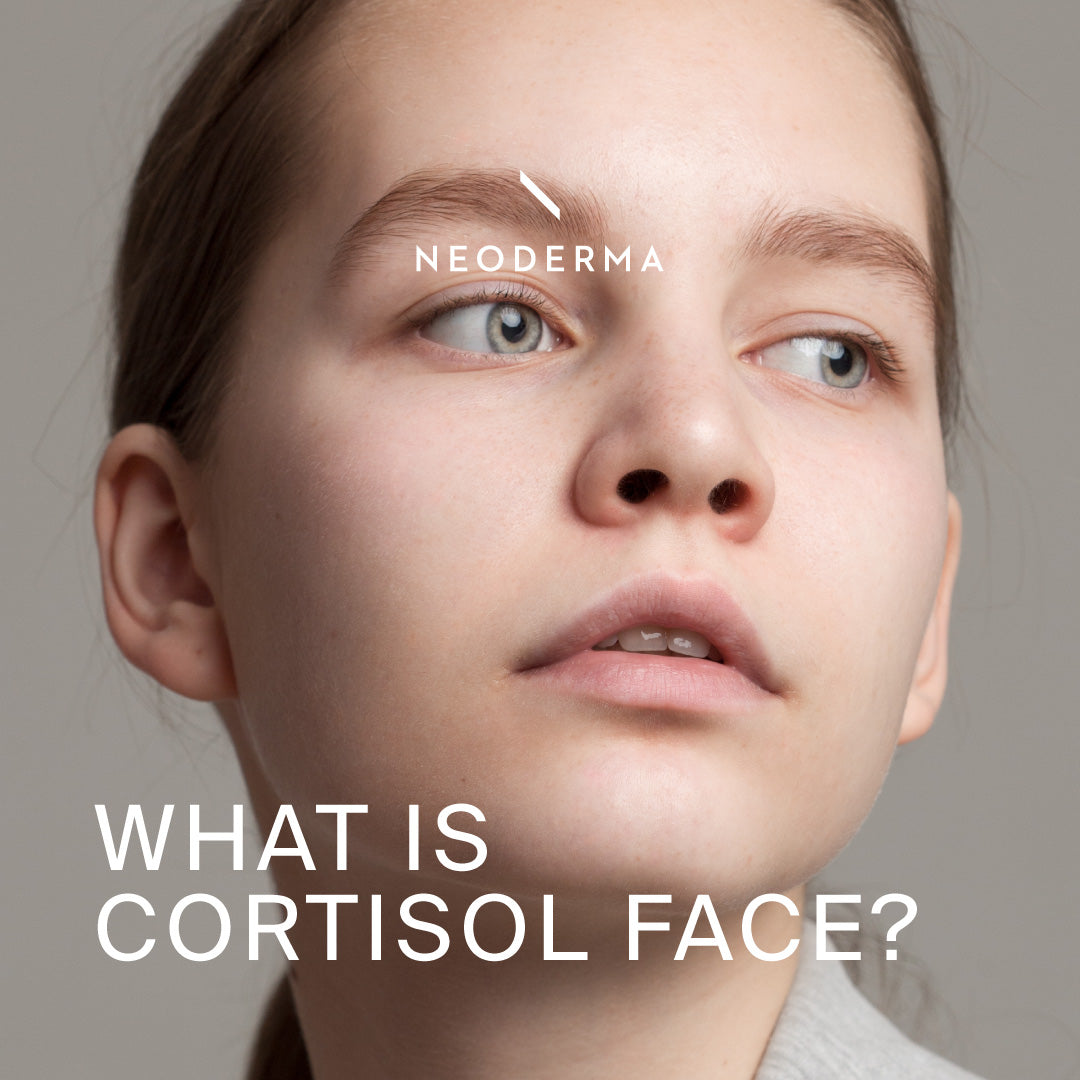 What is Cortisol Face?