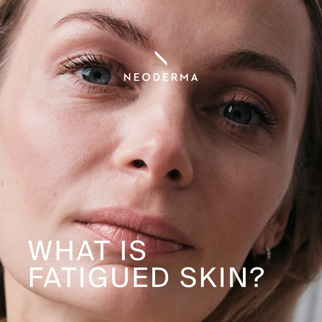 What is Fatigued Skin?