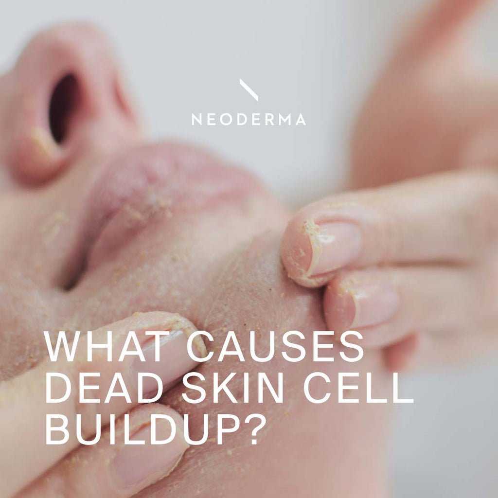 What Causes Dead Skin Cell Buildup?