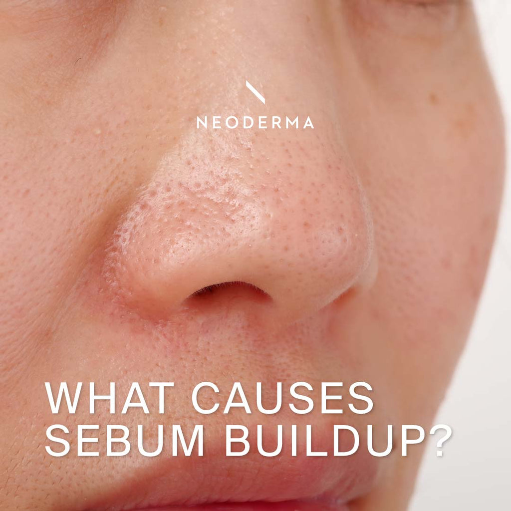 What Causes Sebum Buildup?