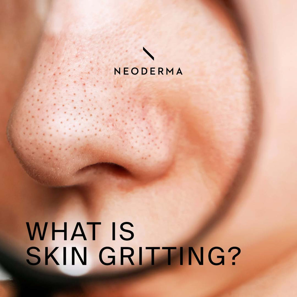 What is Skin Gritting?