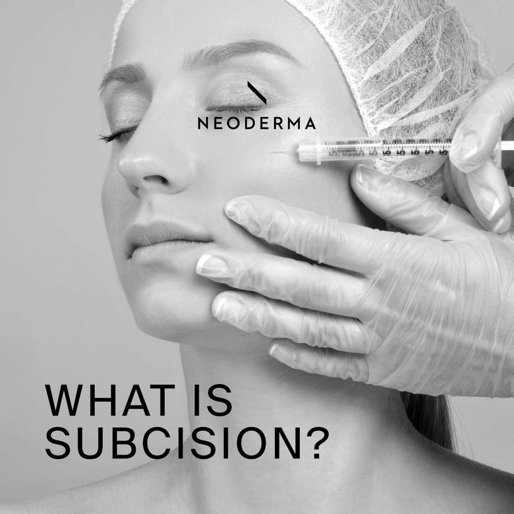 What is Subcision?