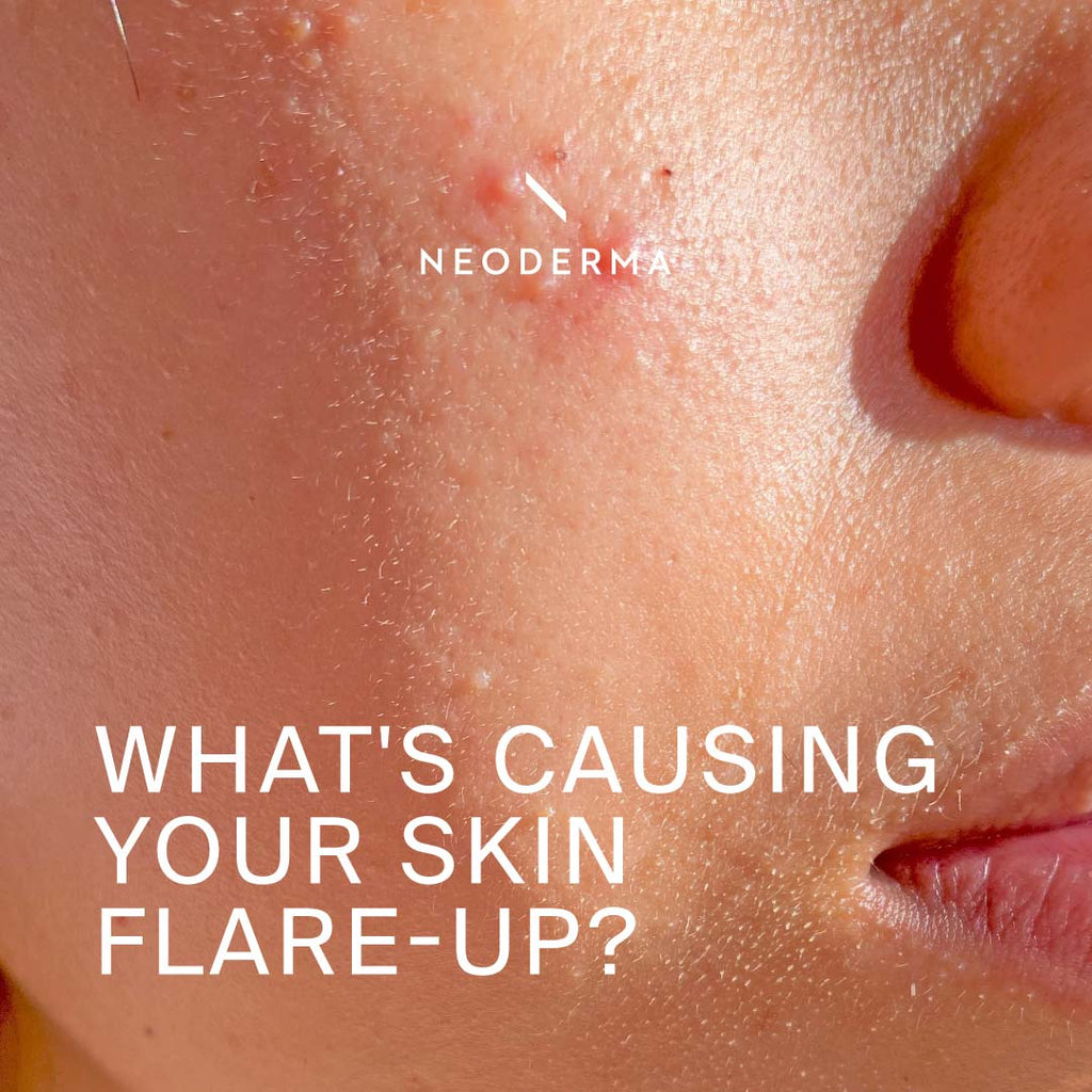 What's Causing Your Skin Flare-Up?