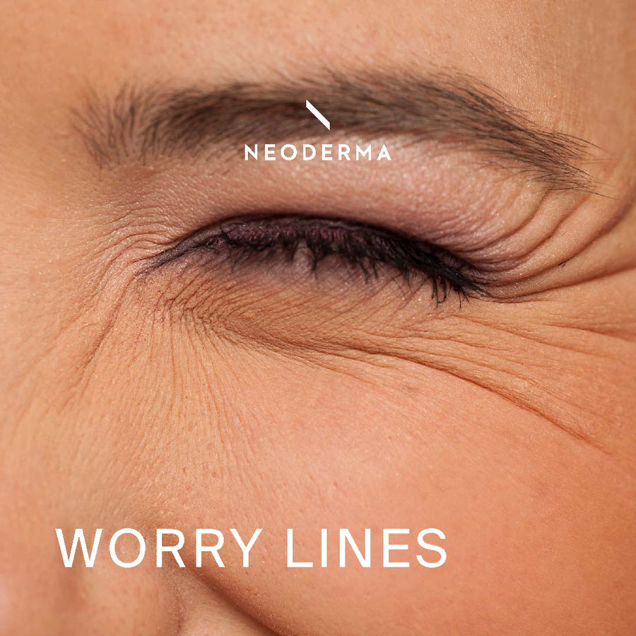 Worry Lines